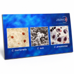 Chlamydia Species Summary Model